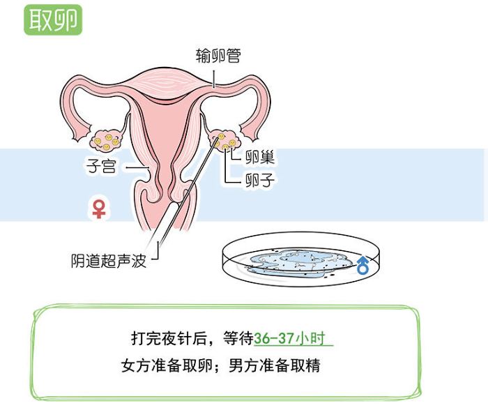 湖南供卵助孕全流程详解 从申请到移植时间线